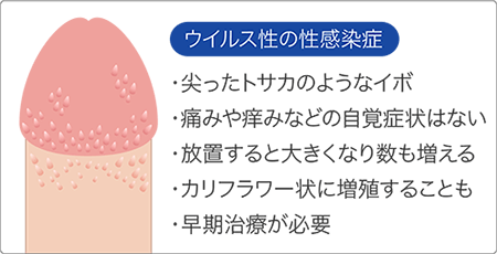 尖圭コンジローマの症状