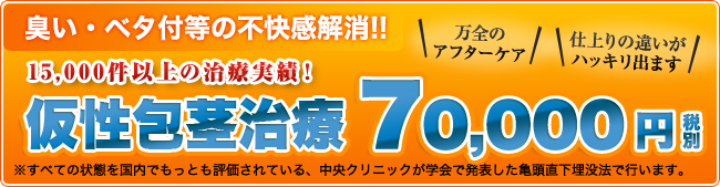 15,000件以上の治療実績!仮性包茎治療70,000円