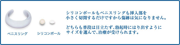 シリコンボール 包茎手術 亀頭増大治療なら神奈川の川崎中央クリニック