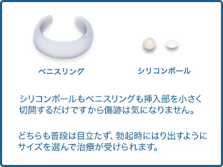 シリコンボール 薄毛 Aga治療 Ed治療薬処方 美容外科形成外科 川崎中央クリニック メンズサイト